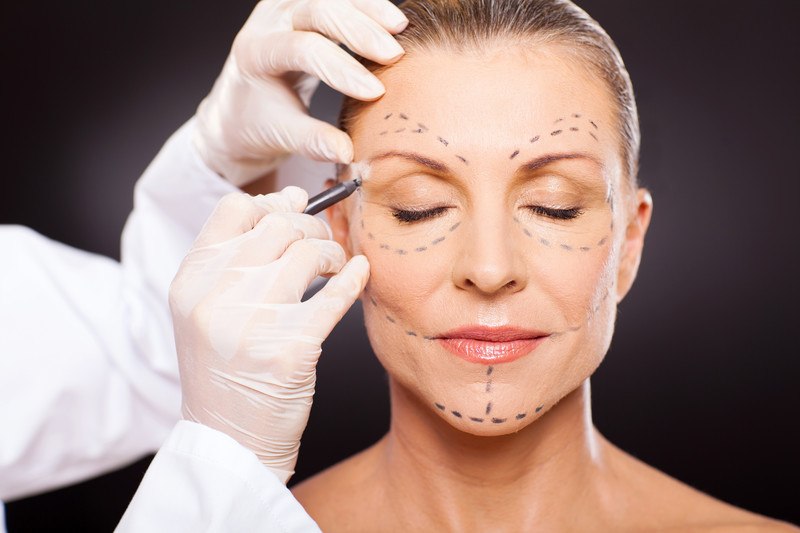 This image shows a woman with her eyes closed, while someone in white latex gloves and a white lab coat draws dotted lines on her face with dark pencil, representing the best cosmetic surgery affiliate programs.